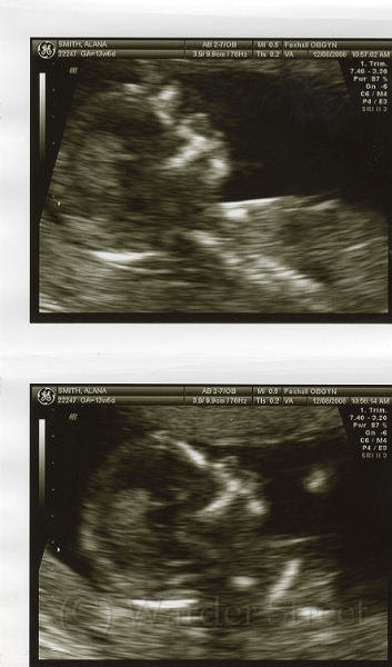 2nd Ultrasound 01.jpg